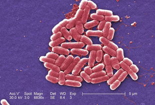 大肠细菌多会造成屁多吗,放屁多是什么原因造成的？可能会有什么危害吗？